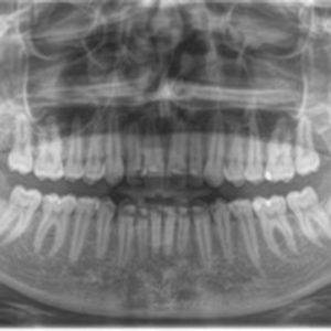 Meet your Posher, Pete